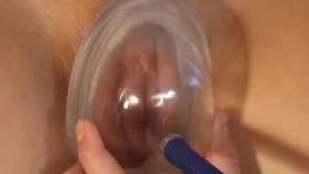 膣ポンプ