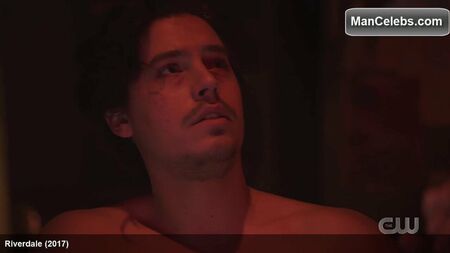 コール・スプラウス、毛のない腹筋