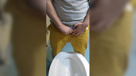 FTMの尿道形成術後の立位排尿