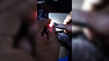 アジア人女性が自身の陰茎小帯を切断した